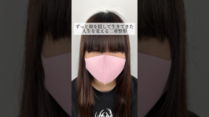 【朗報】引きこもり女子高生の人生、『二重整形』により一瞬で変わってしまうｗｗｗｗｗｗｗｗ (動画あり)